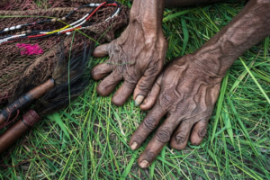 Niki Paleg atau Potong Jari Suku Dani, Papua. Sumber Foto: Twitter