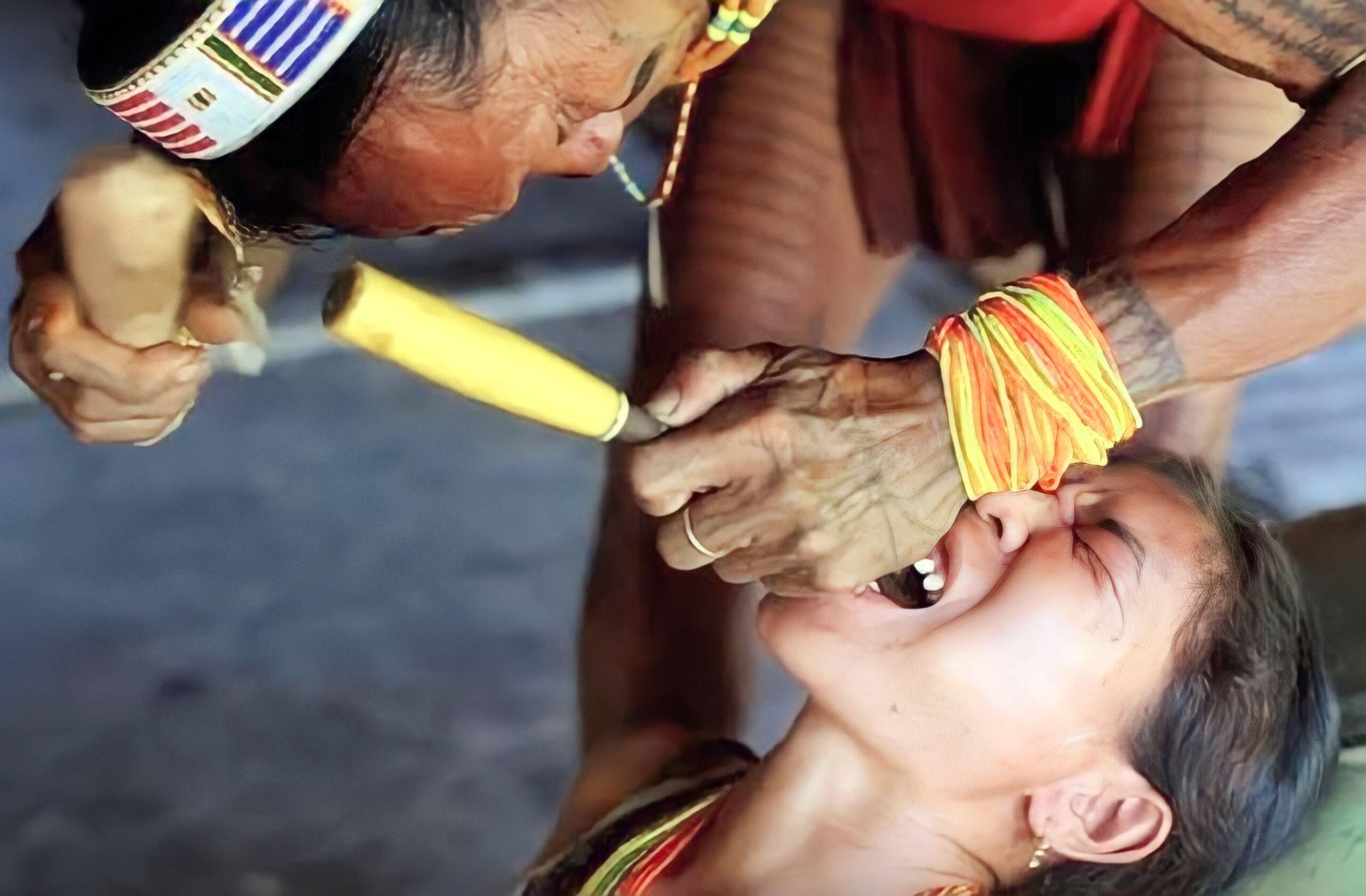 Proses Peruncingan Gigi Suku Mentawai. Sumber Foto: Twitter ViolletaVio1