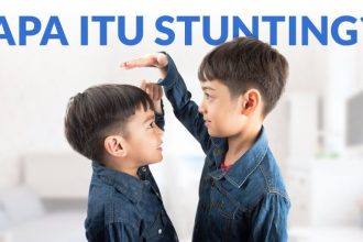 Ilustrasi Stunting.